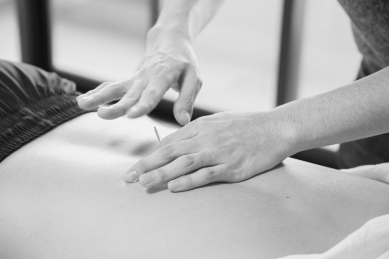 Acupuncture Stirling Physiotherapy, Sports Injury & Massage Clinic